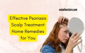 Effective Psoriasis Scalp Treatment Home Remedies for You
