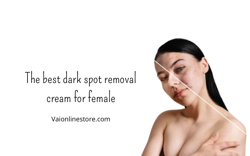 The best dark spot removal cream for female