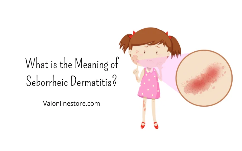 best treatment for seborrheic dermatitis on face