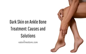 Dark Skin on Ankle Bone Treatment