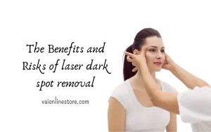Thе Bеnеfits and Risks of laser dark spot removal: Is It Worth It?